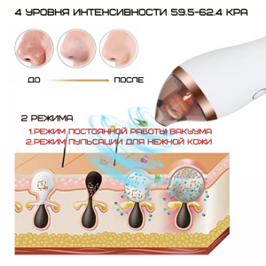 Вакуумний очищувач пор обличчя SUYANMEI 049 функція банкової терапії та прилад для пілінгу 2 режими + 4 рівні інтенсивності. Photo 3